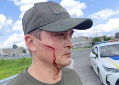 На Украине мужчина разогнал банду людоловов с помощью лопаты