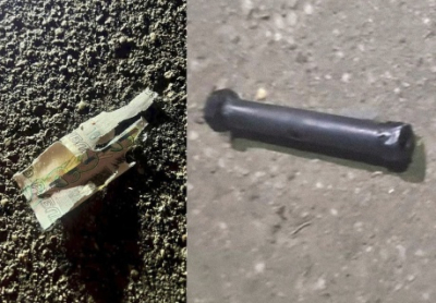 «Не обошлось без участия украинских спецслужб». В Подмосковье мальчик лишился пальцев из-за взорвавшейся купюры