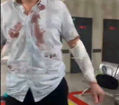 В Одесском ТЦК мобилизованный порезал себе вены