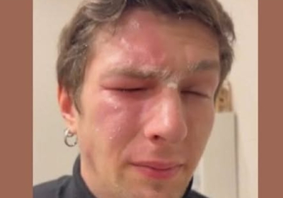 Во Львове соседка напала на «ветерана ВСУ», распылив перцовый баллончик ему в лицо